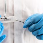 coronavirus-test-mostoles