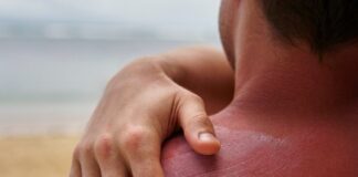 La Asociación Española contra el Cáncer impulsa la prevención este verano en Móstoles