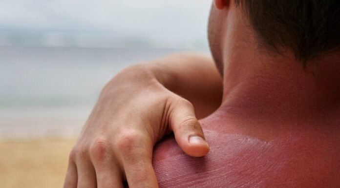 La Asociación Española contra el Cáncer impulsa la prevención este verano en Móstoles