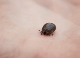 Fallece el vecino de Móstoles afectado por la fiebre hemorrágica de Crimea-Congo