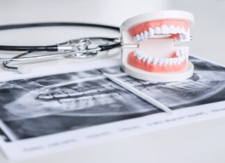 Móstoles ya trabaja en la viabilidad de un servicio bucodental gratis a personas vulnerables Móstoles ya trabaja en la viabilidad de un servicio bucodental gratis a personas vulnerables